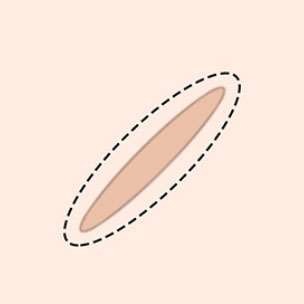 콘텐츠 이미지