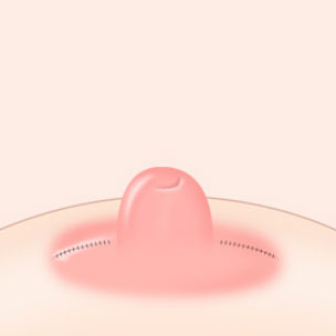 콘텐츠 이미지