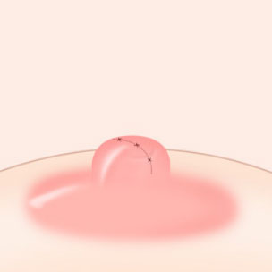 콘텐츠 이미지