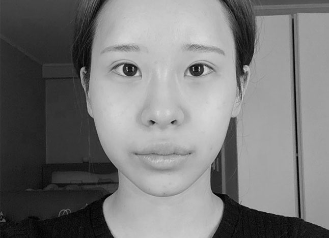 가슴 before 이미지