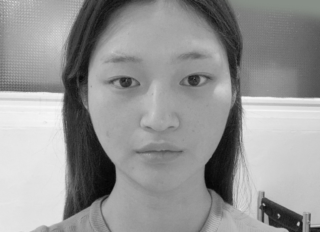 가슴 before 이미지