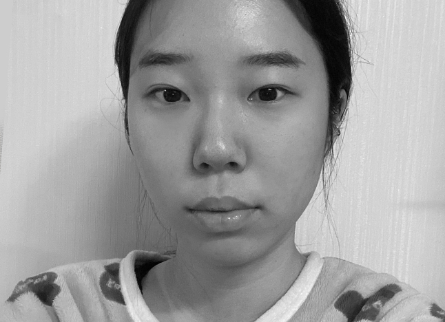 가슴 before 이미지