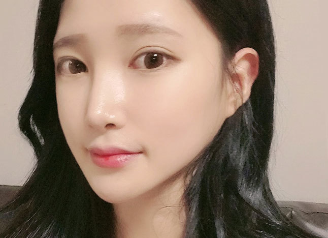 가슴 after 이미지