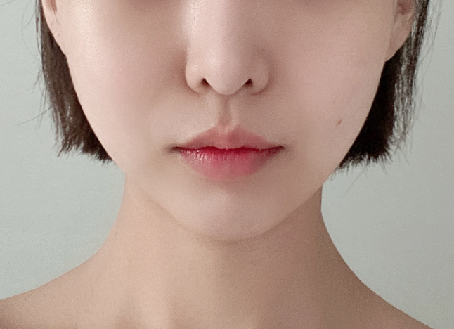 가슴 after 이미지