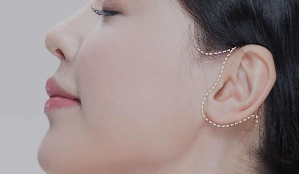 콘텐츠 이미지
