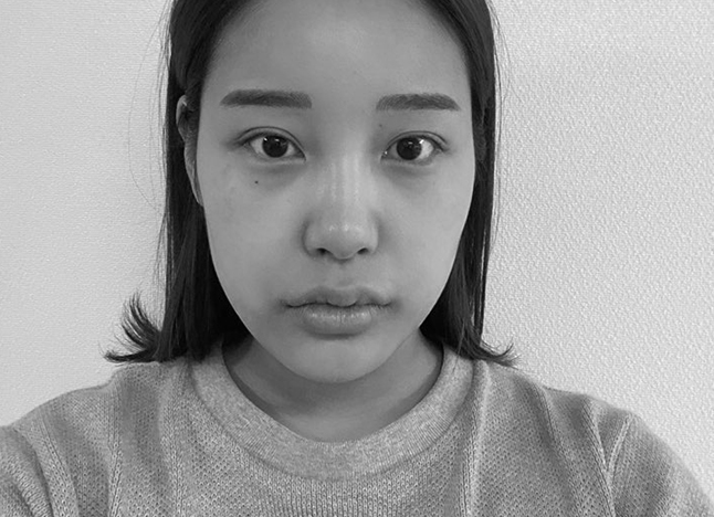 가슴 before 이미지
